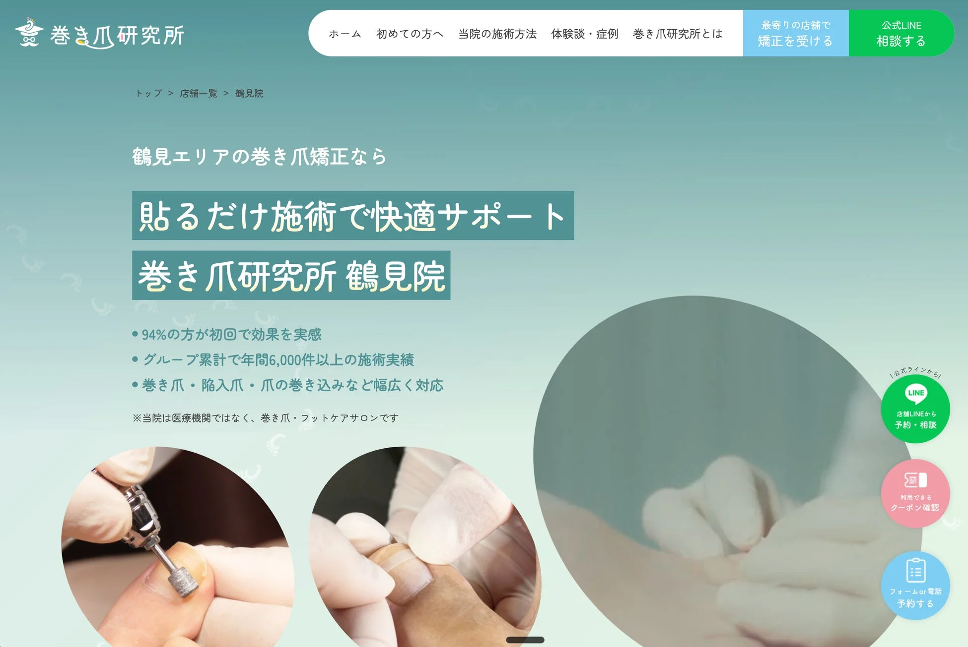 巻き爪研究所のウェブサイト画面